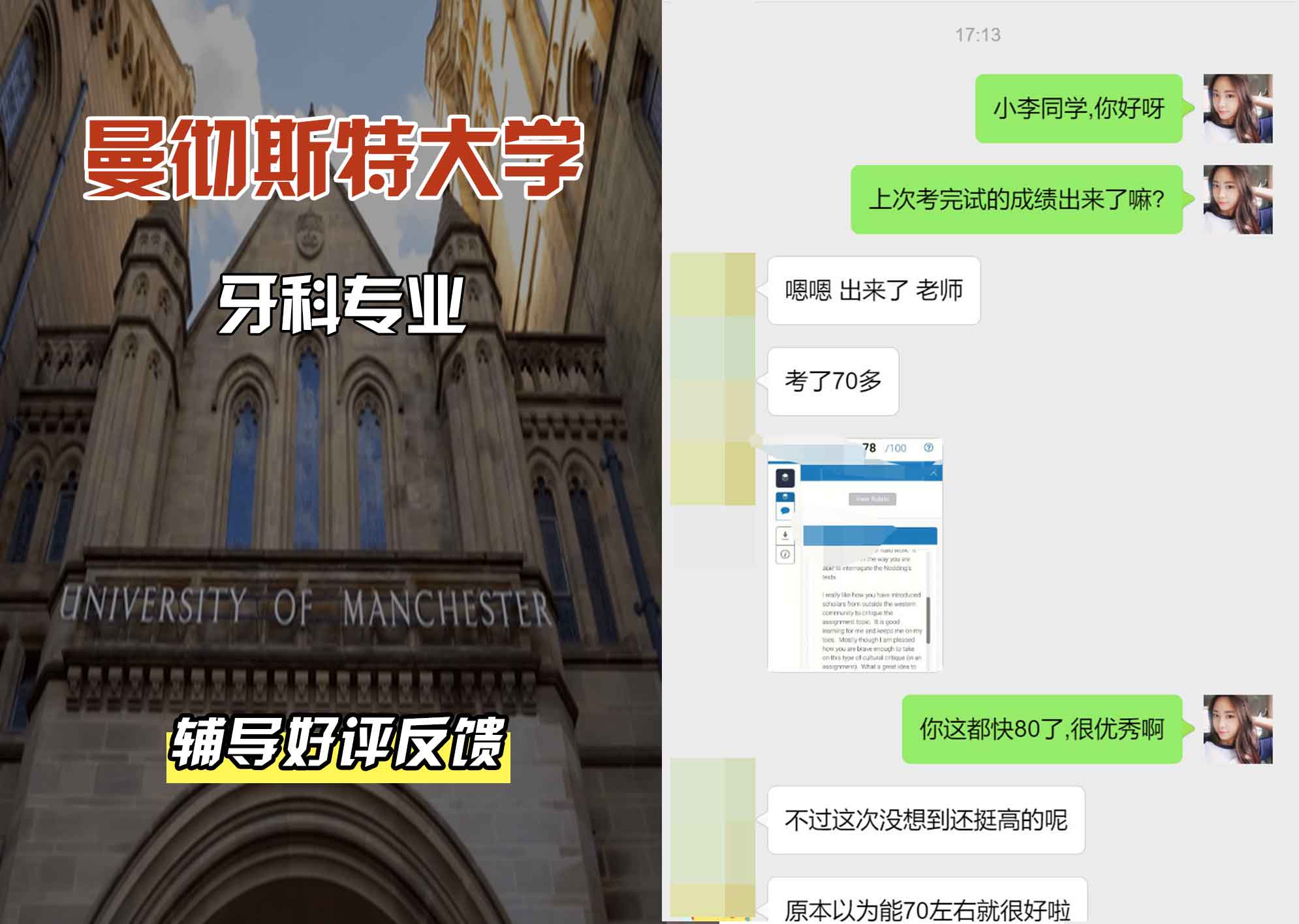曼彻斯特大学曼大牙科专业辅导好评反馈