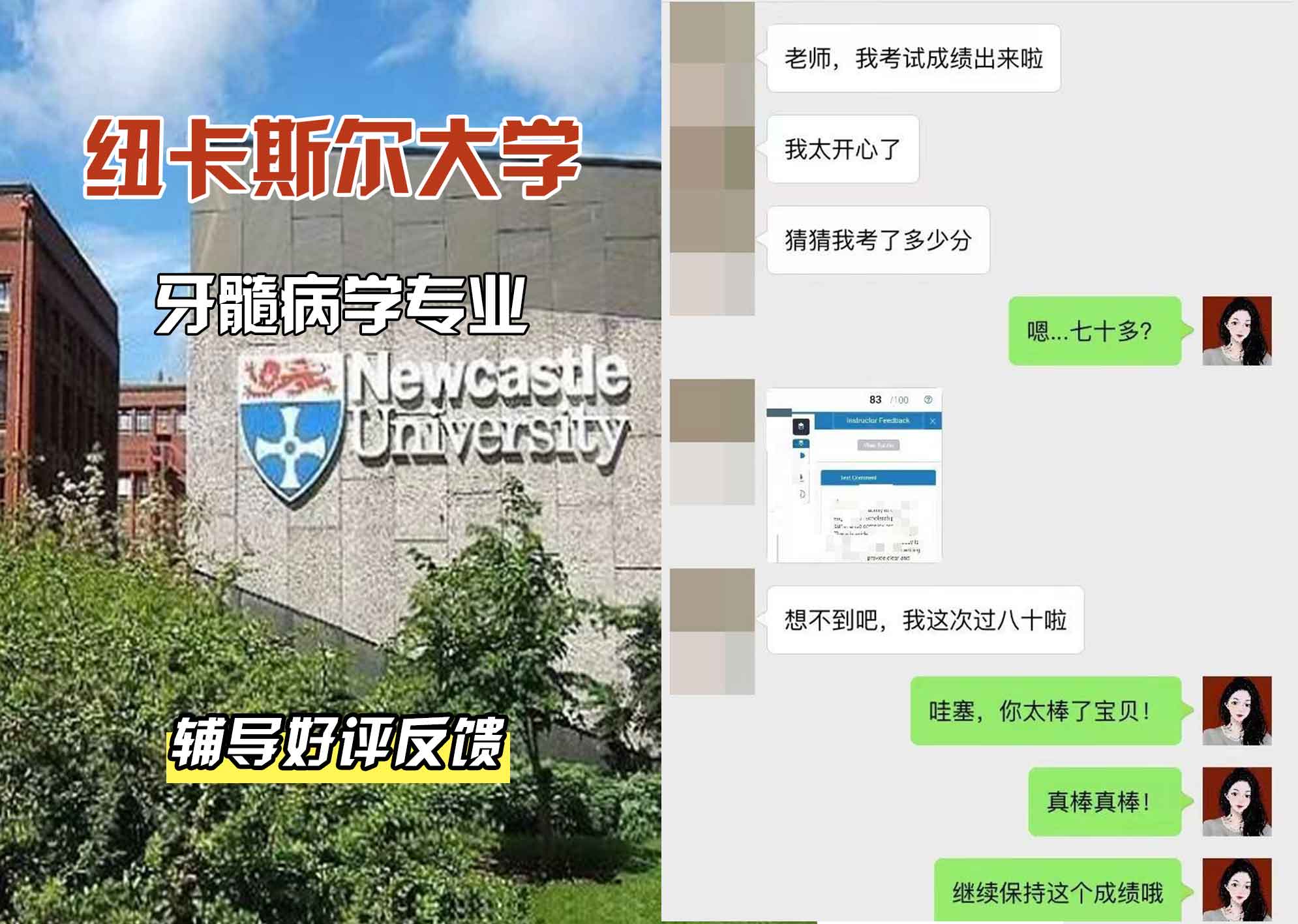 纽卡斯尔大学纽大牙髓病学辅导好评反馈