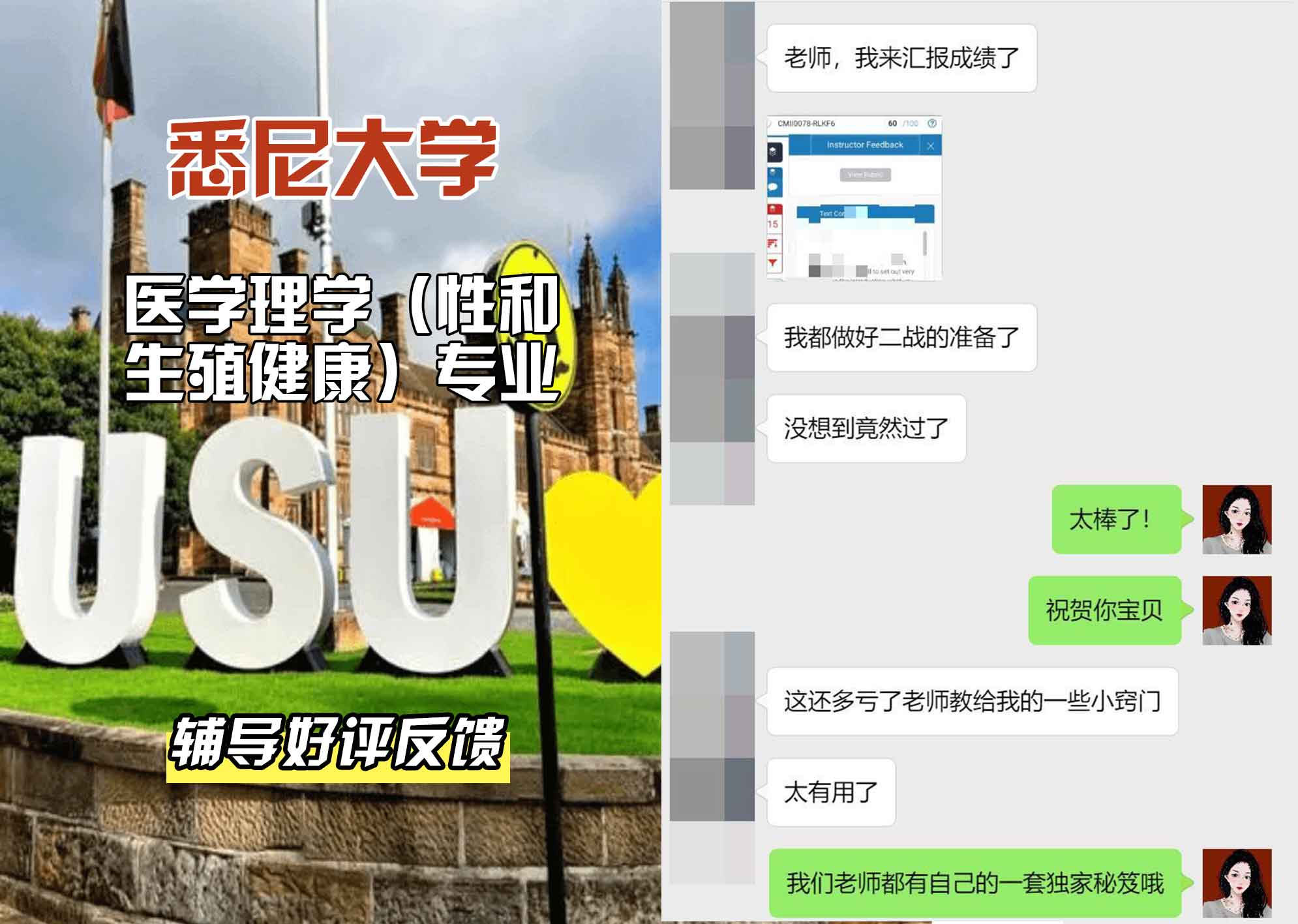 悉尼大学USYD医学理学（性和生殖健康）辅导好评反馈