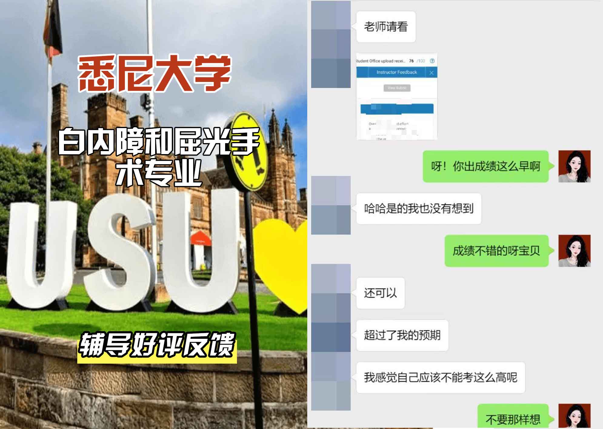 悉尼大学USYD白内障和屈光手术辅导好评反馈